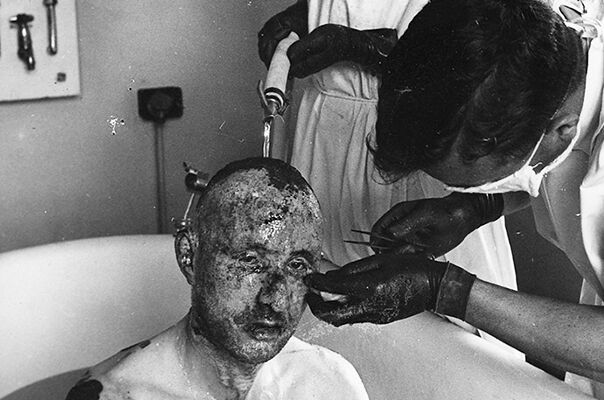 An injured airman is attended to by medical staff at the Queen Victoria Hospital, East Grinstead (Copyright: East Grinstead Museum)