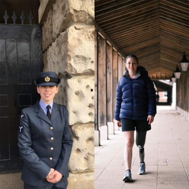 Stacey in RAF uniform and Stacey post-op 